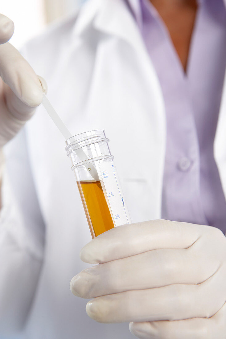 Urine sample analysis