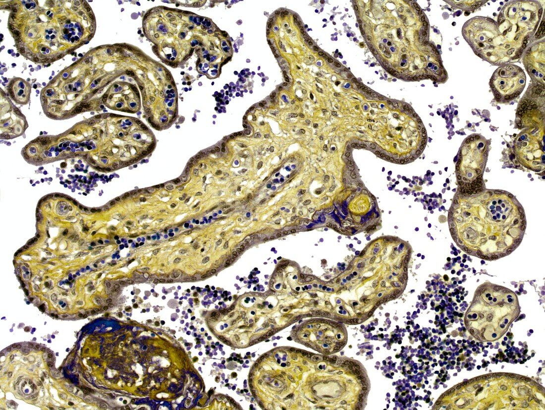 Placenta,light micrograph
