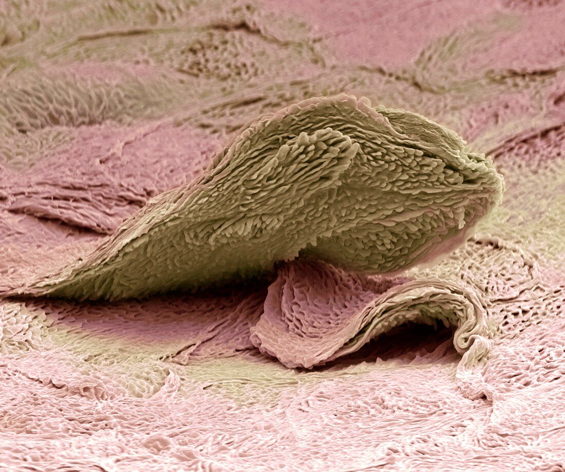 Skin cell,SEM