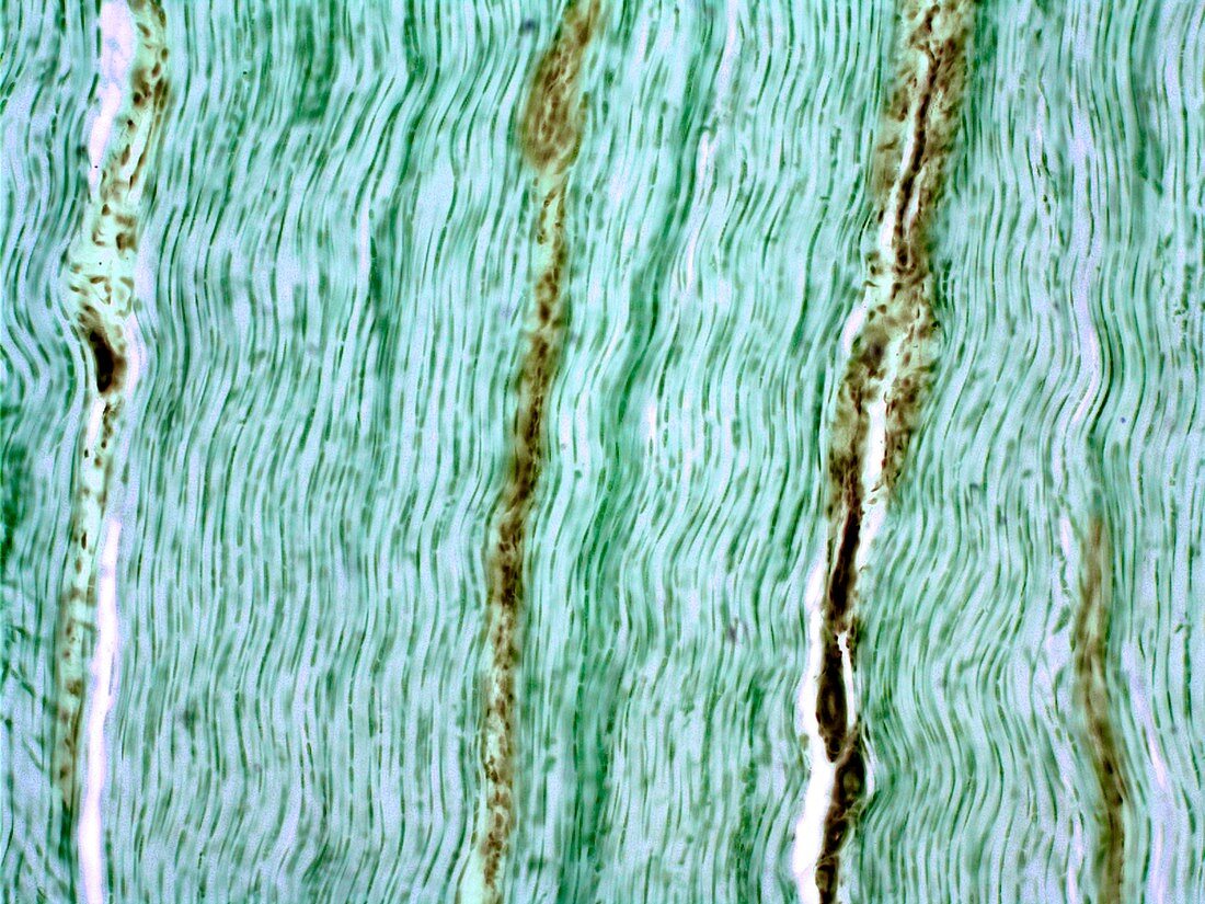 Tendon,light micrograph