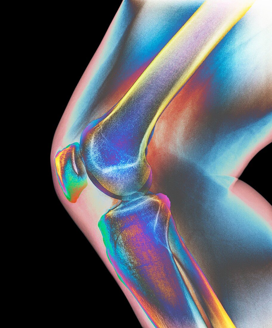 Normal knee,X-ray