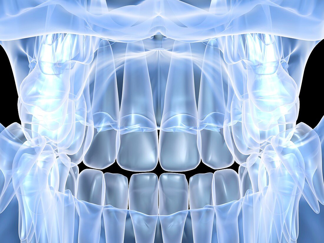 Human skull with teeth,computer artwork