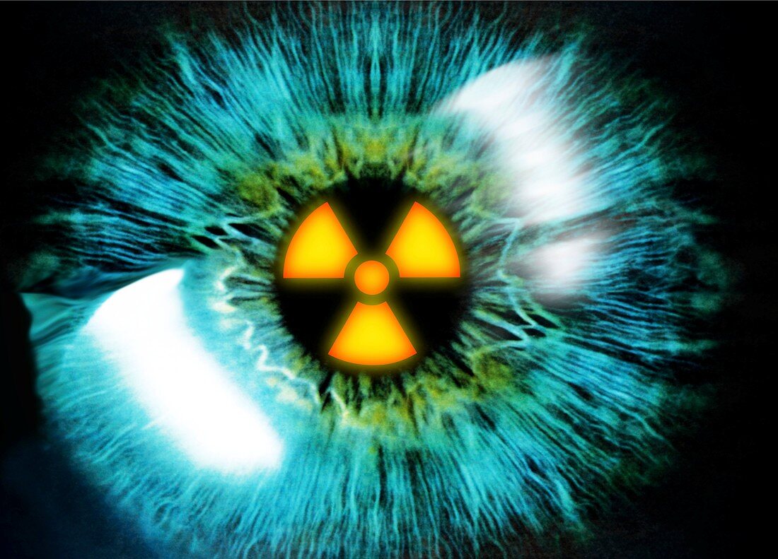 Iris with radiation warning sign