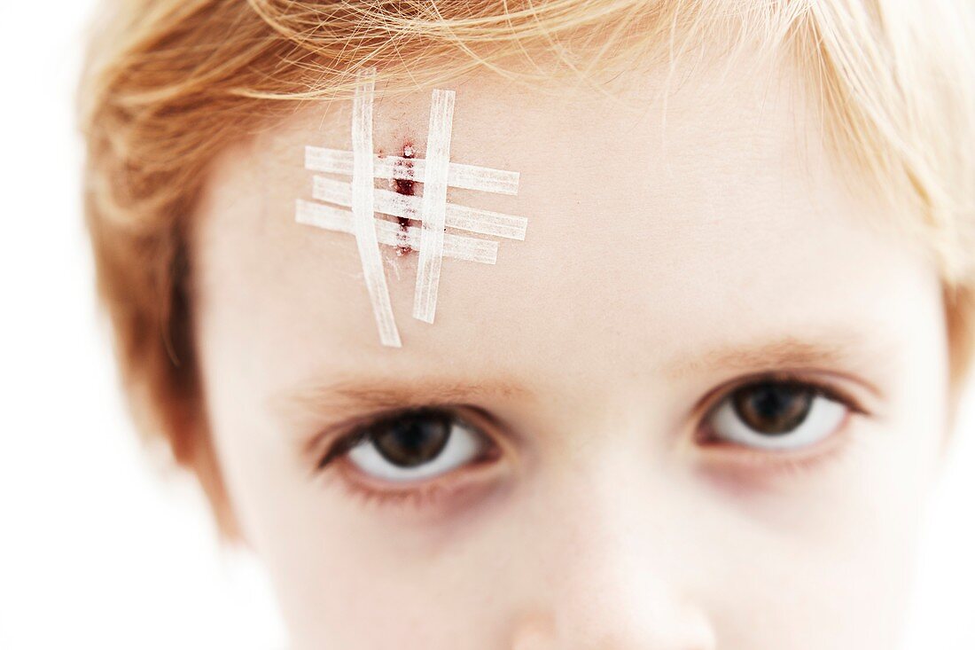 Young boy with head wound