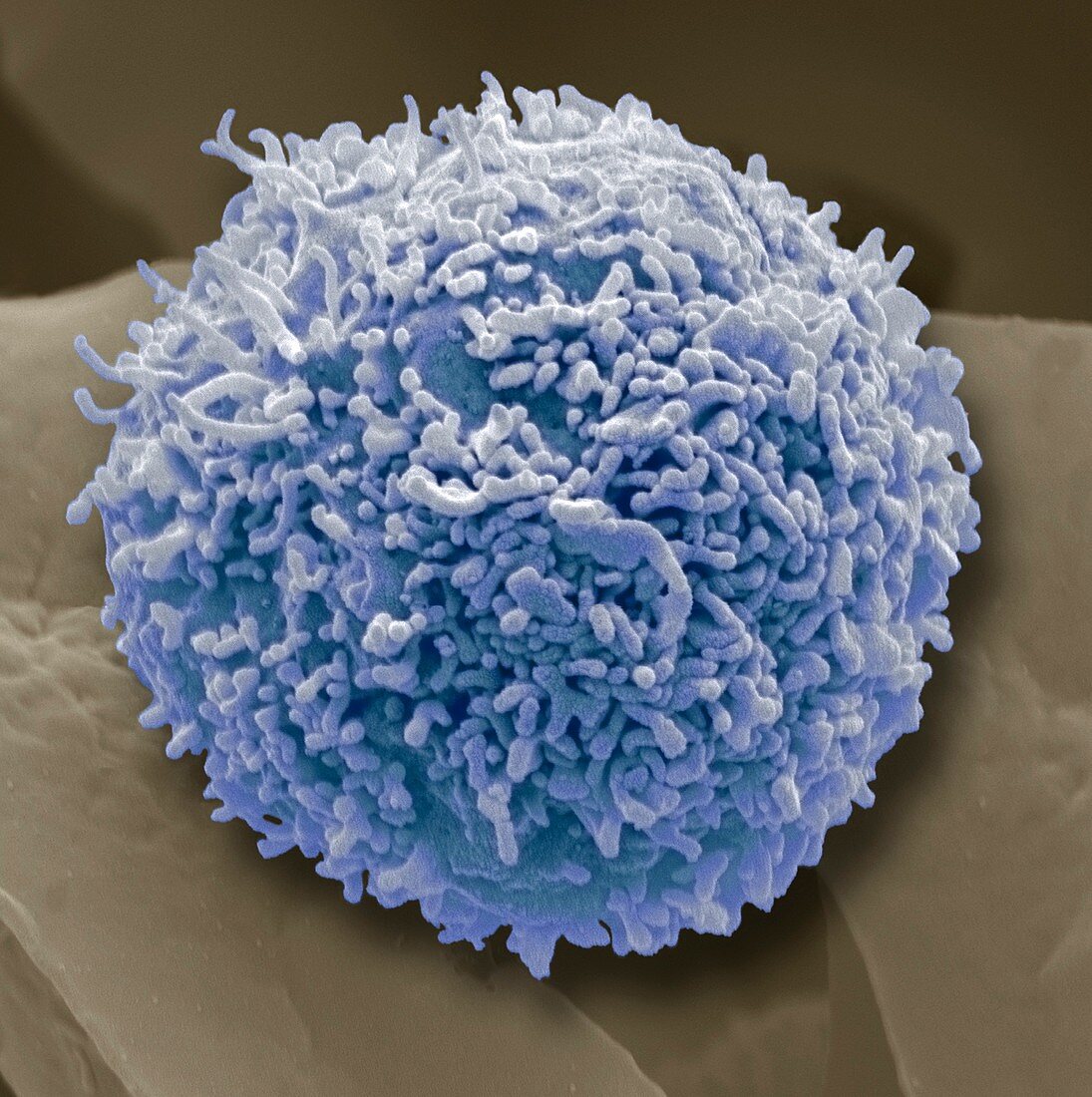 Lymphocyte white blood cell,SEM