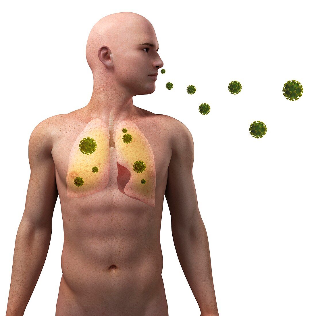 Viral lung infection,conceptual artwork