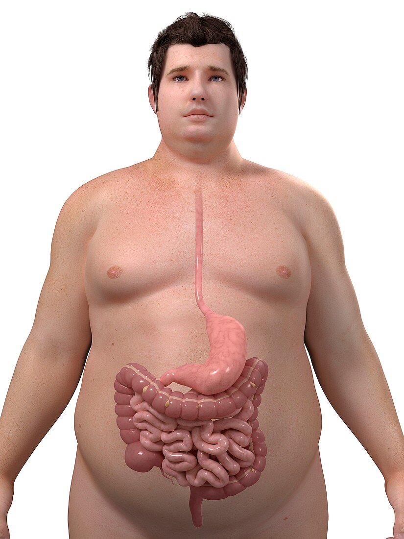 Obese man's digestive system,artwork