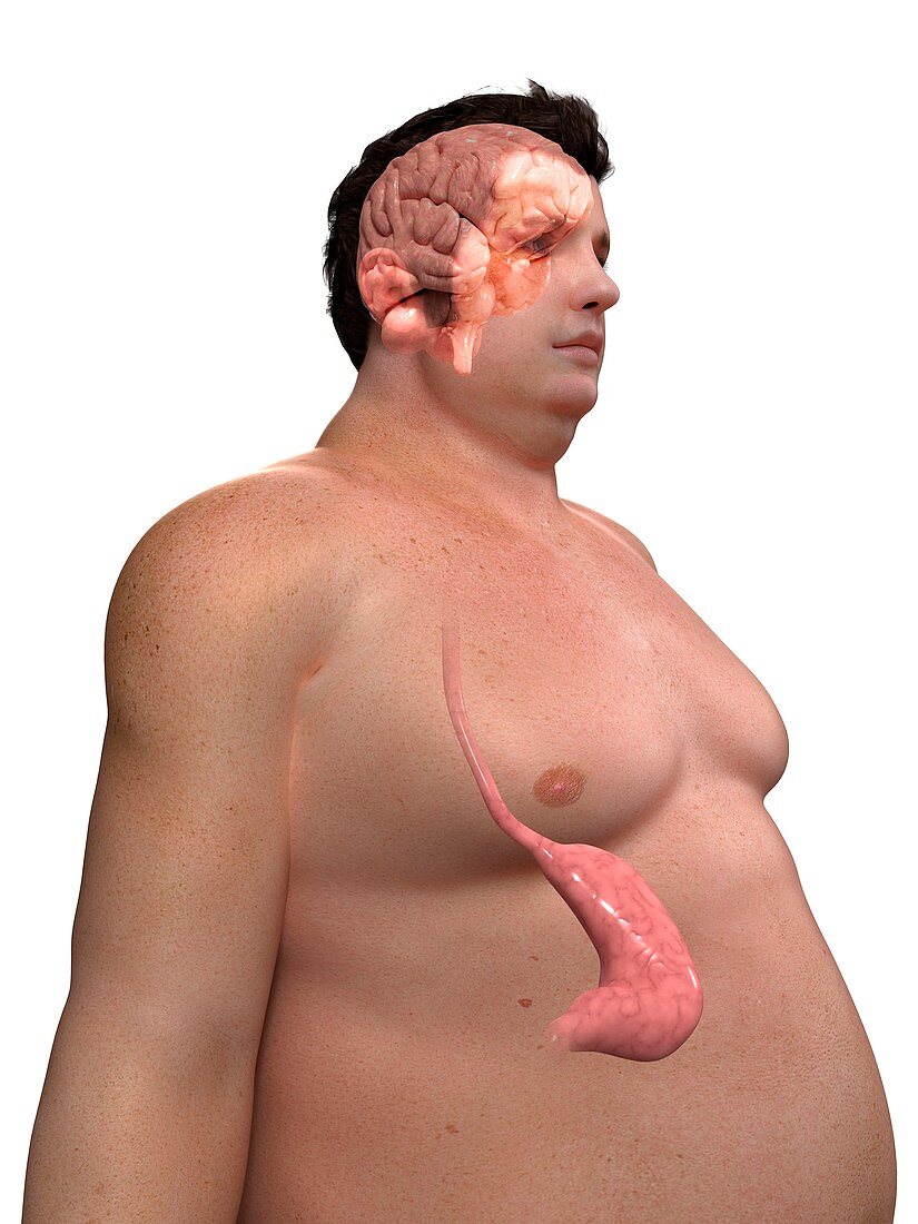 Obese man's stomach,artwork