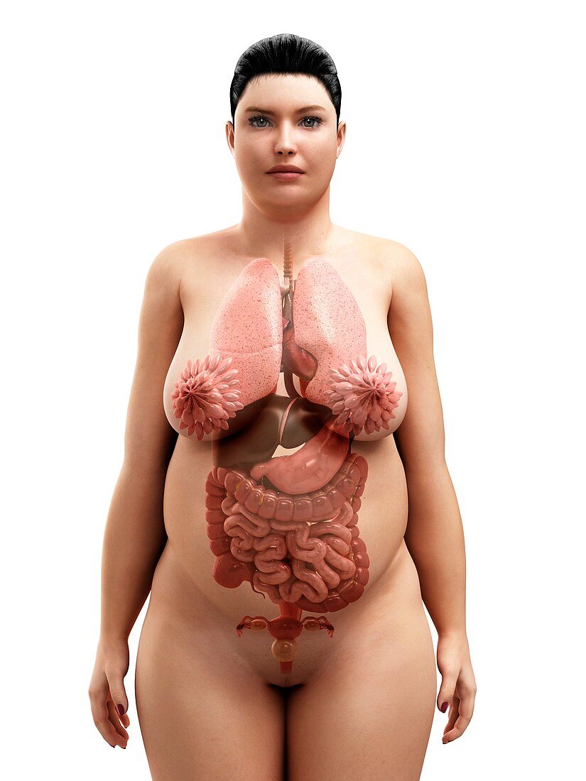 Obese woman's organs,artwork
