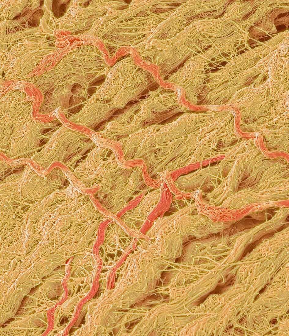 Dense connective tissue,SEM