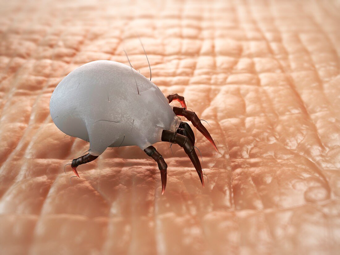 Dust mite,artwork