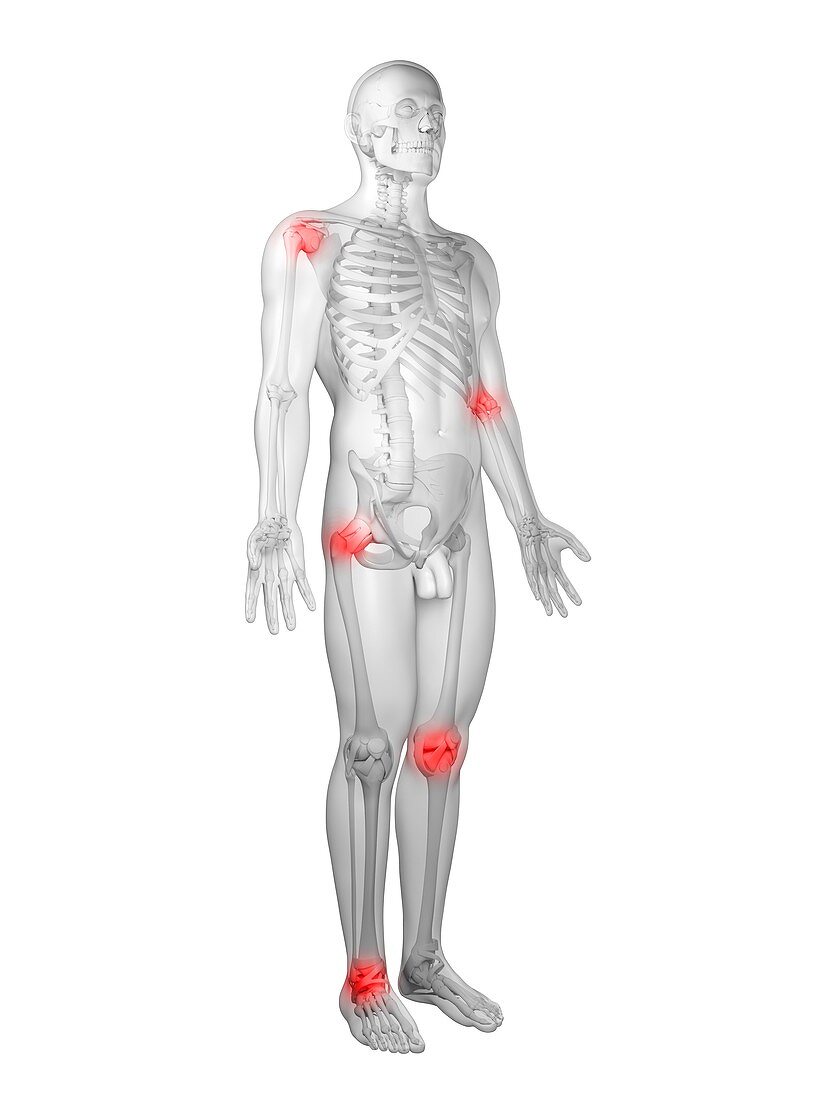 Joint pain,conceptual artwork