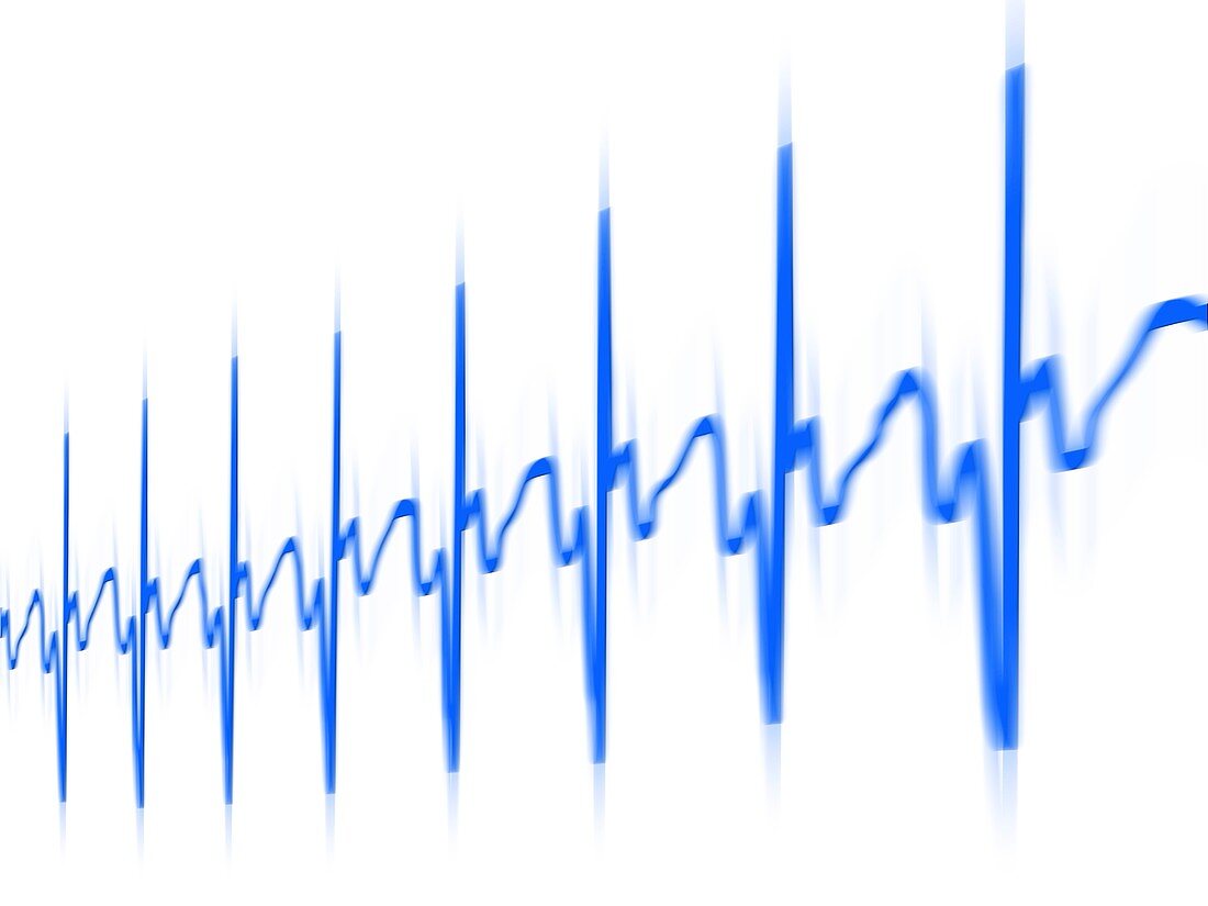 ECG,computer artwork