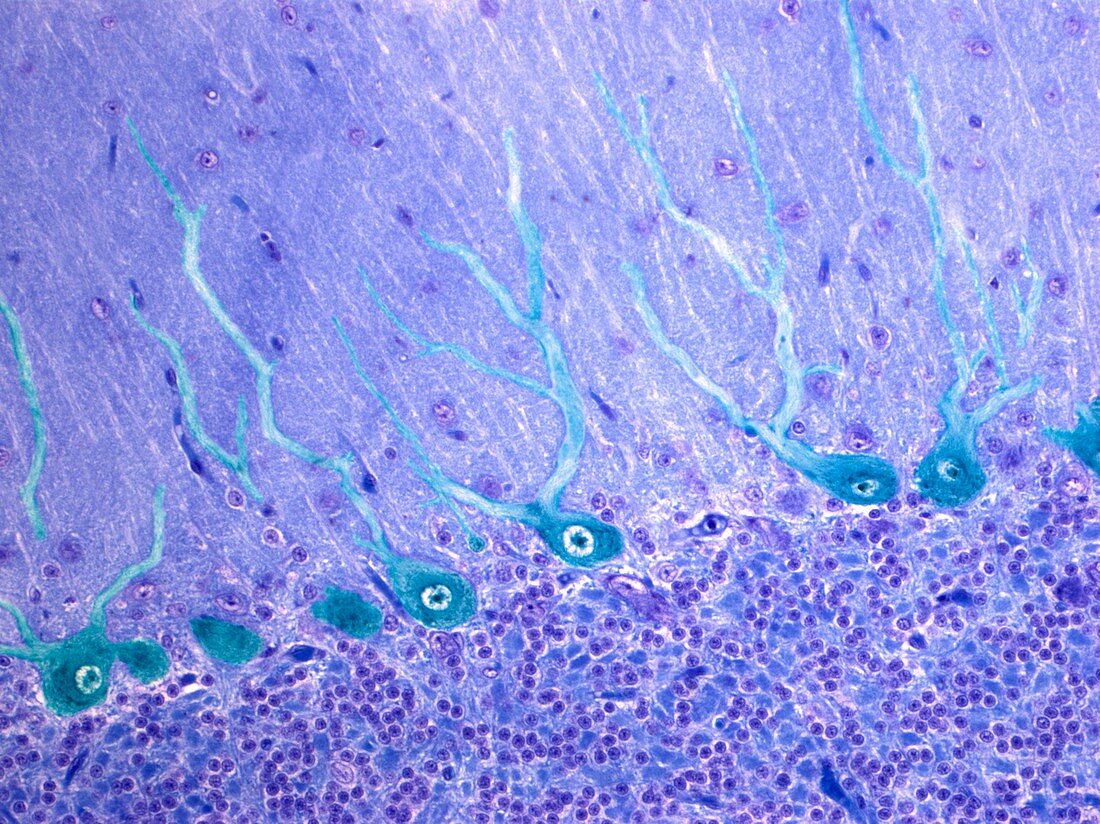 Nerve cells,light micrograph