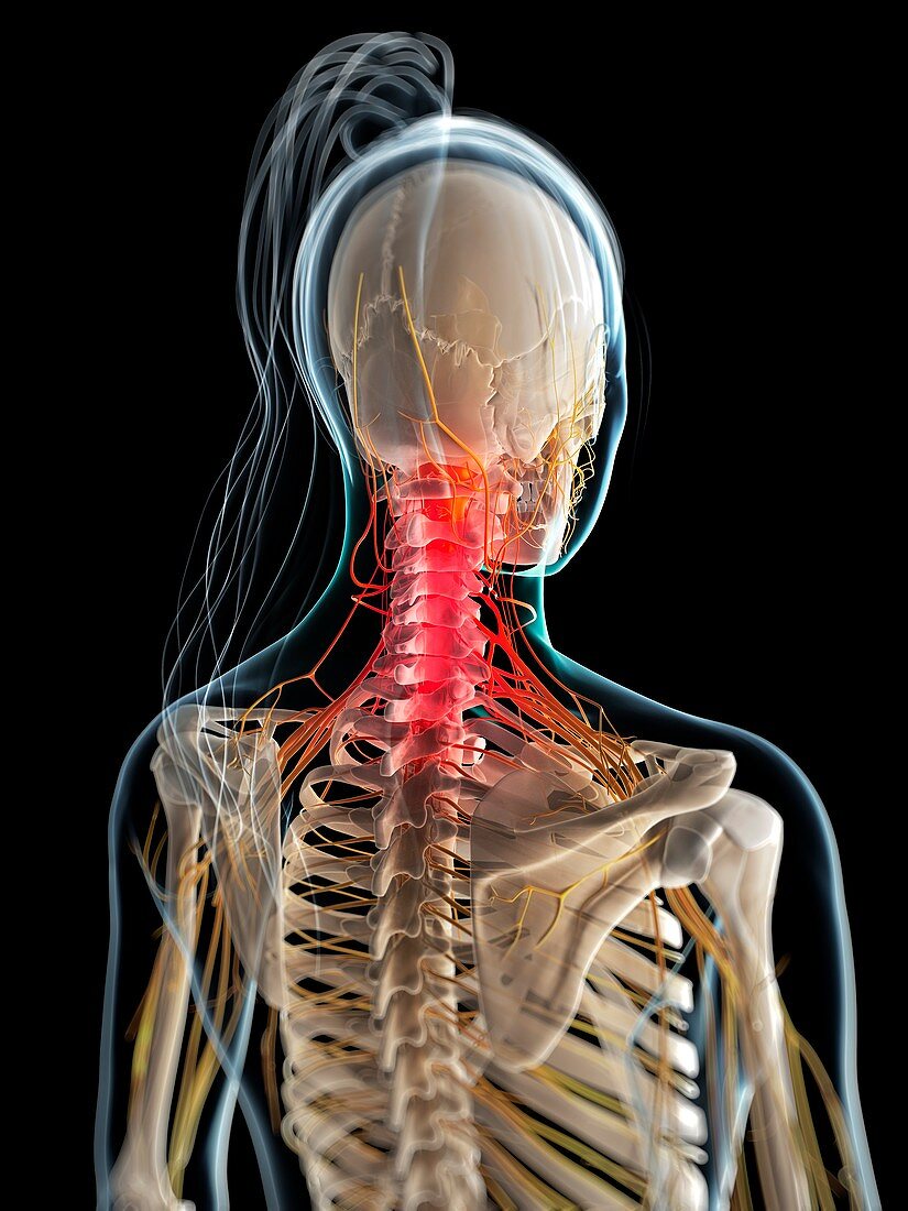 Neck pain,conceptual artwork