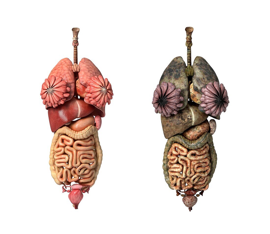 Healthy and diseased organs,artwork
