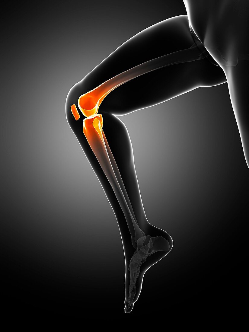 Knee pain,conceptual artwork