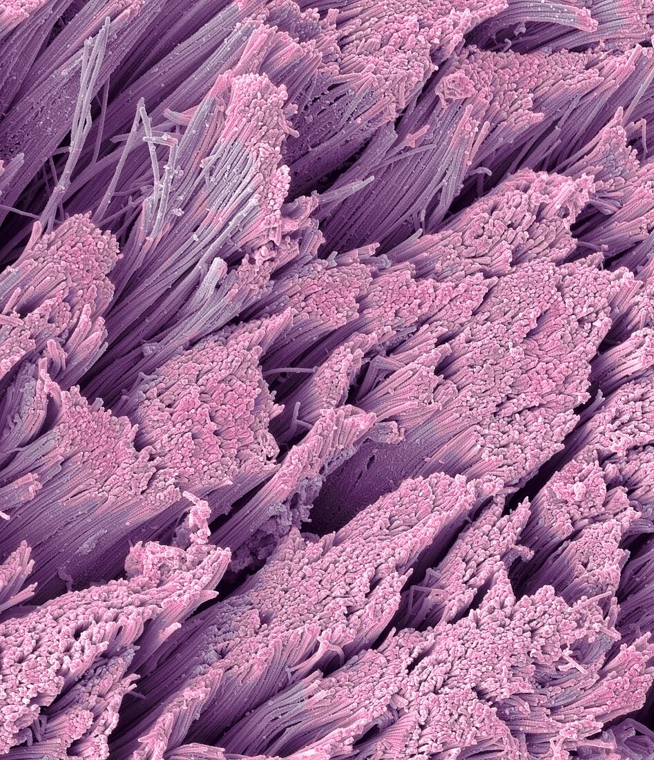 Fractured tendon,SEM