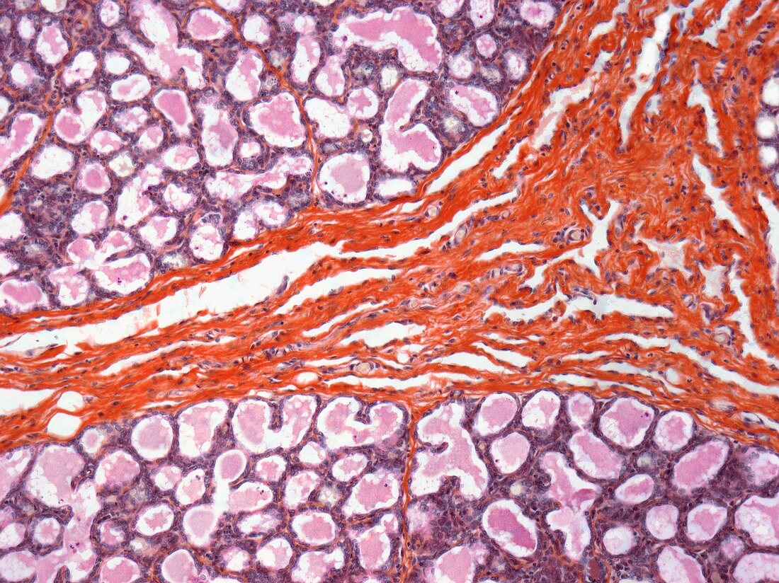 Lactating breast tissue,light micrograph