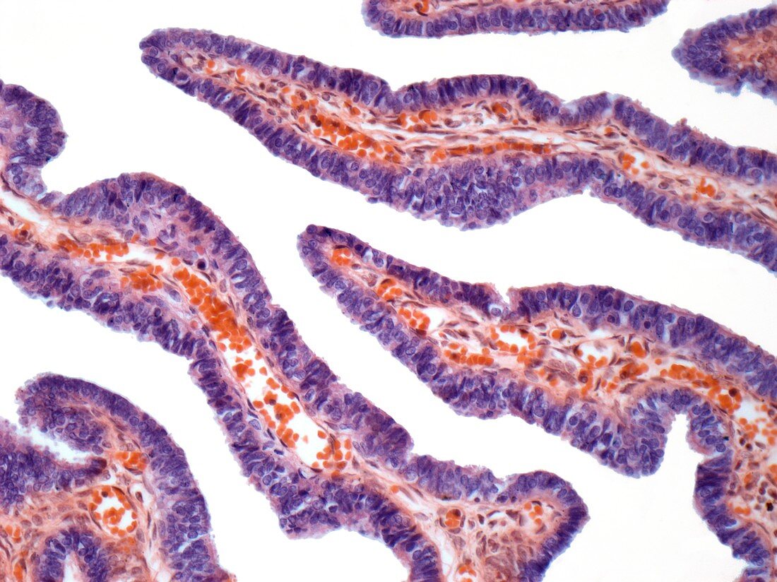 Fallopian tube,light micrograph