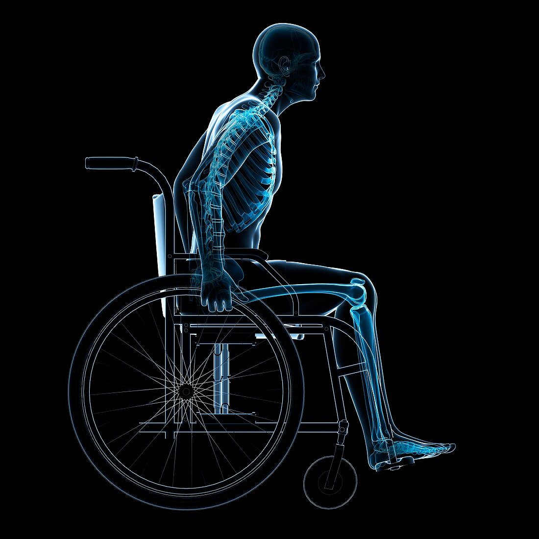 Man in a wheelchair,artwork