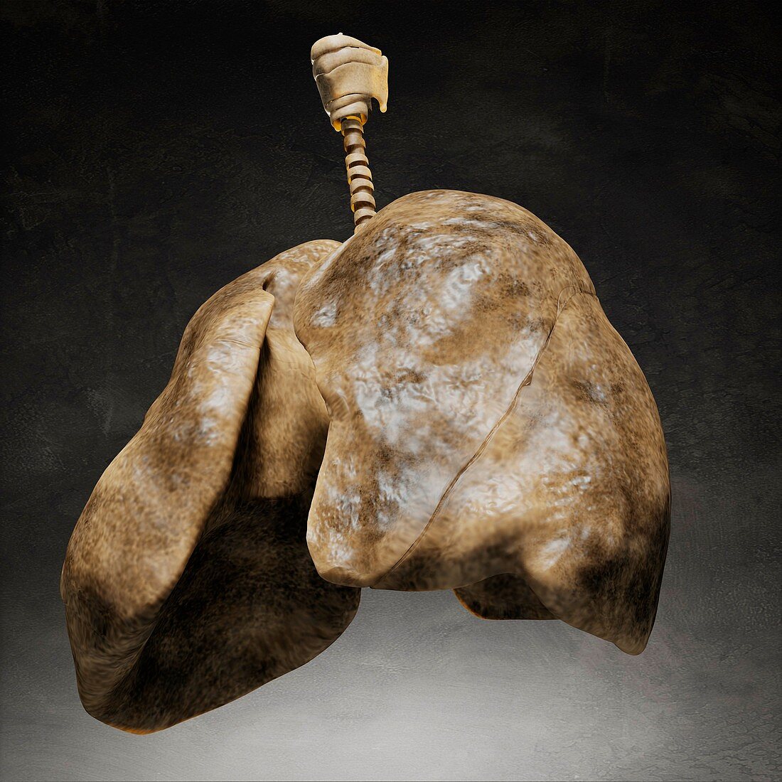 Smoker's lungs,artwork