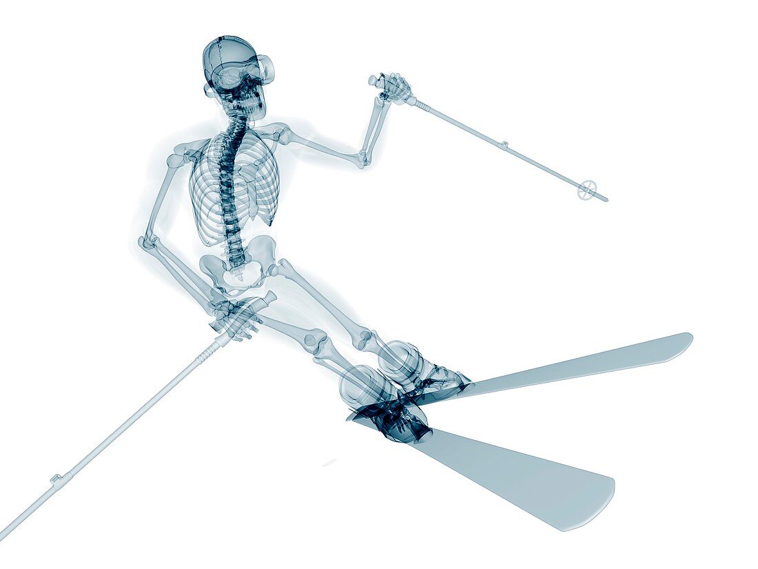 Skeleton skiing,artwork