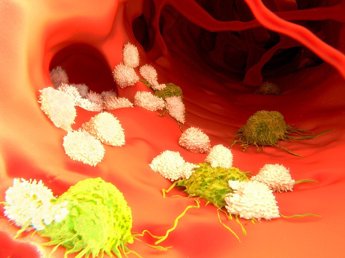 T-lymphocytes and cancer cells,artwork