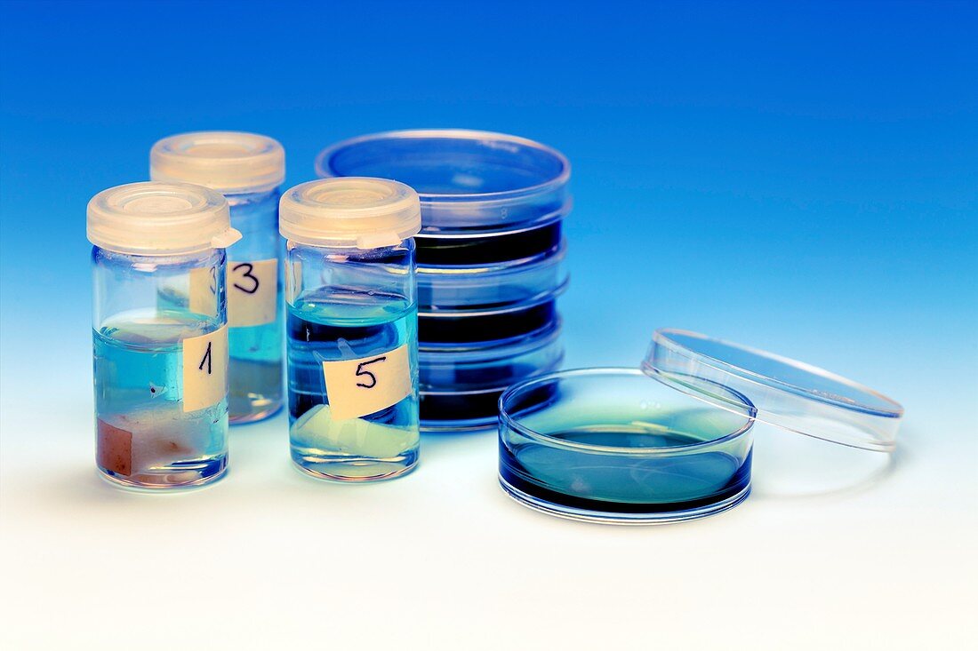 Petri dishes and vials