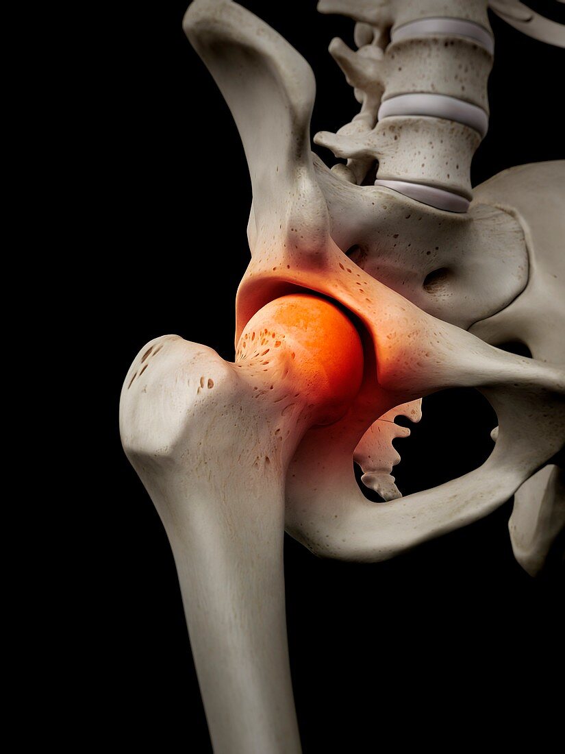 Human hip joint,artwork