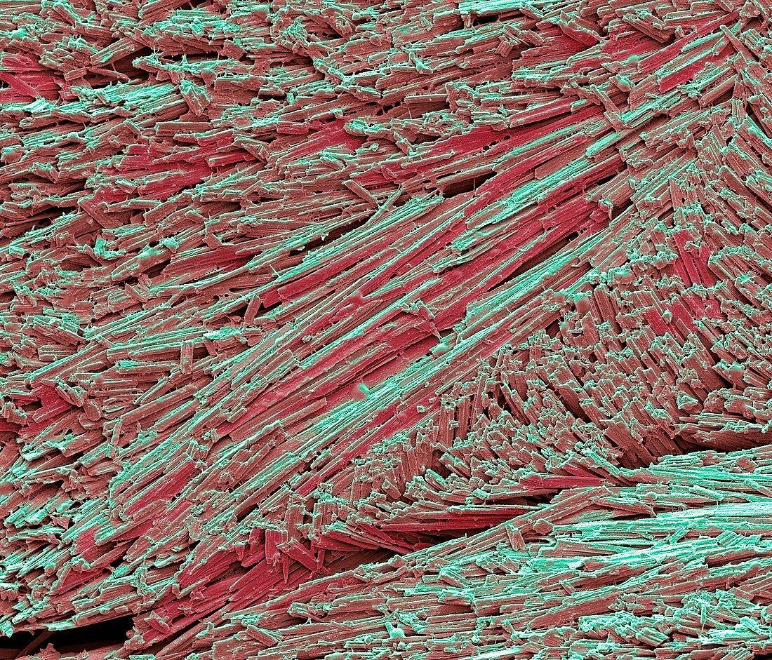 Uric acid crystals,SEM