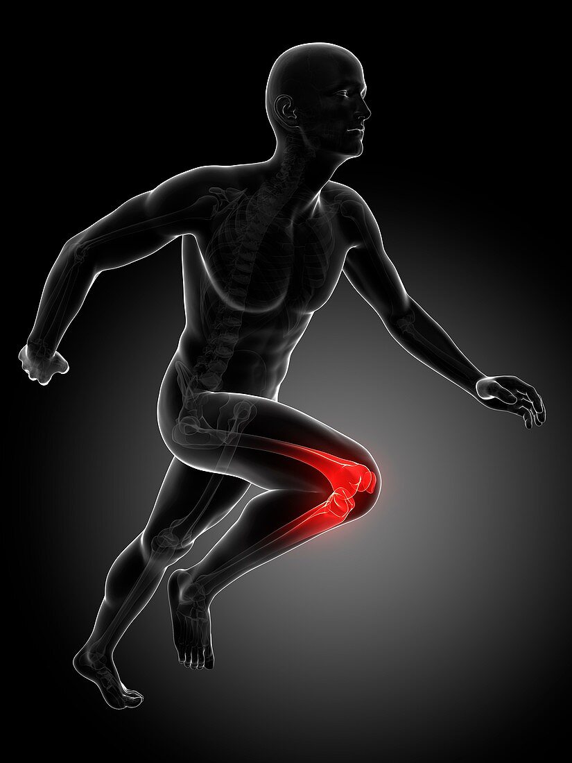 Runner's knee joint,artwork