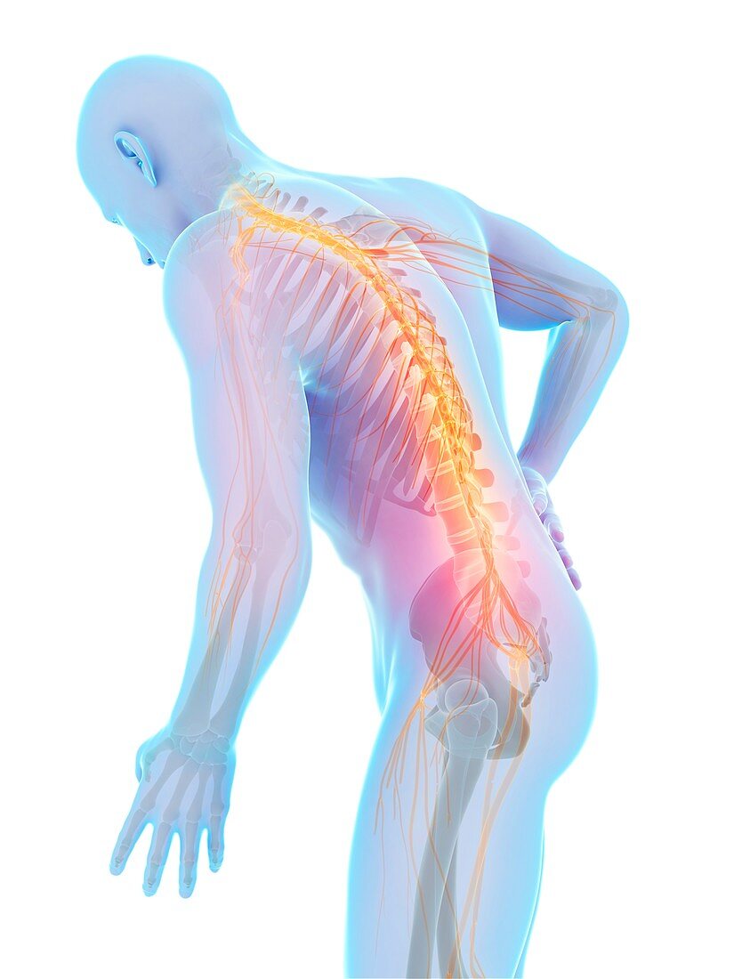 Human back nerve pain,artwork