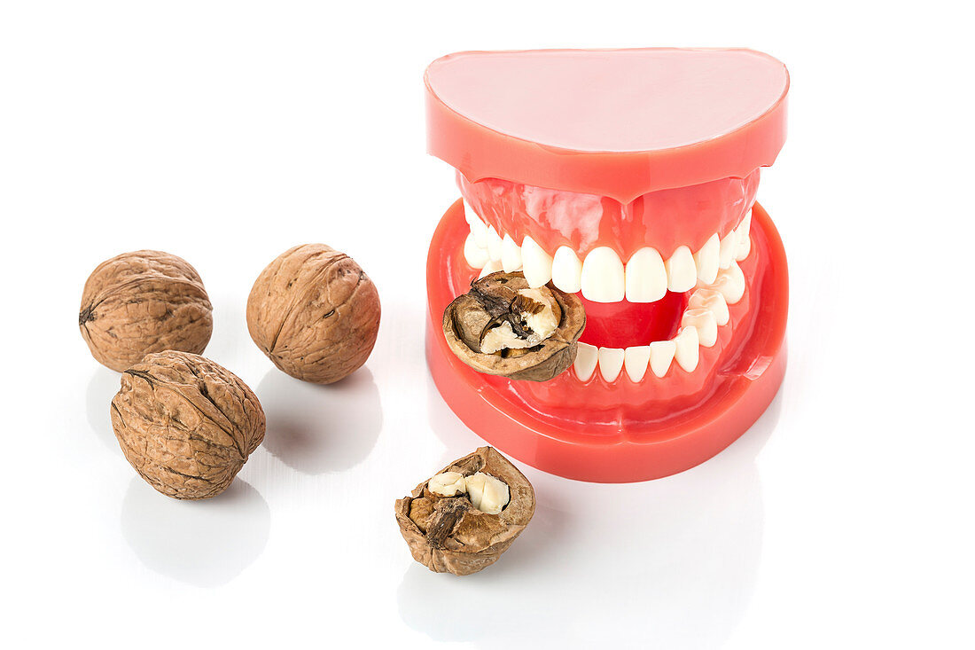 Model of human jaw with walnuts