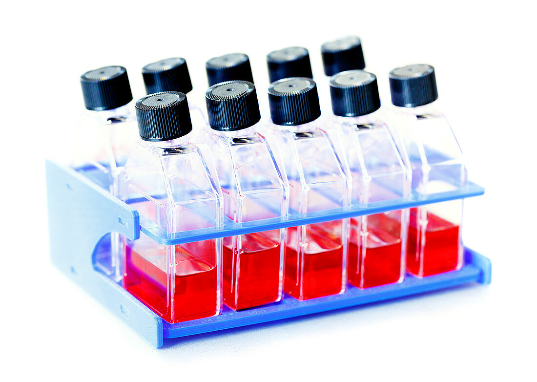 Blood samples in bottles in stand