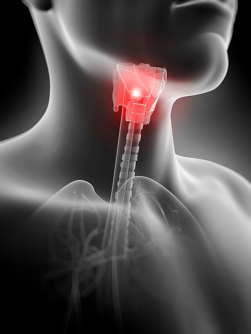 Human thyroid pain,illustration