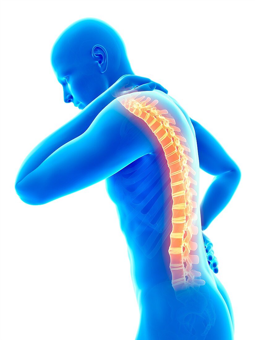 Human back pain,illustration