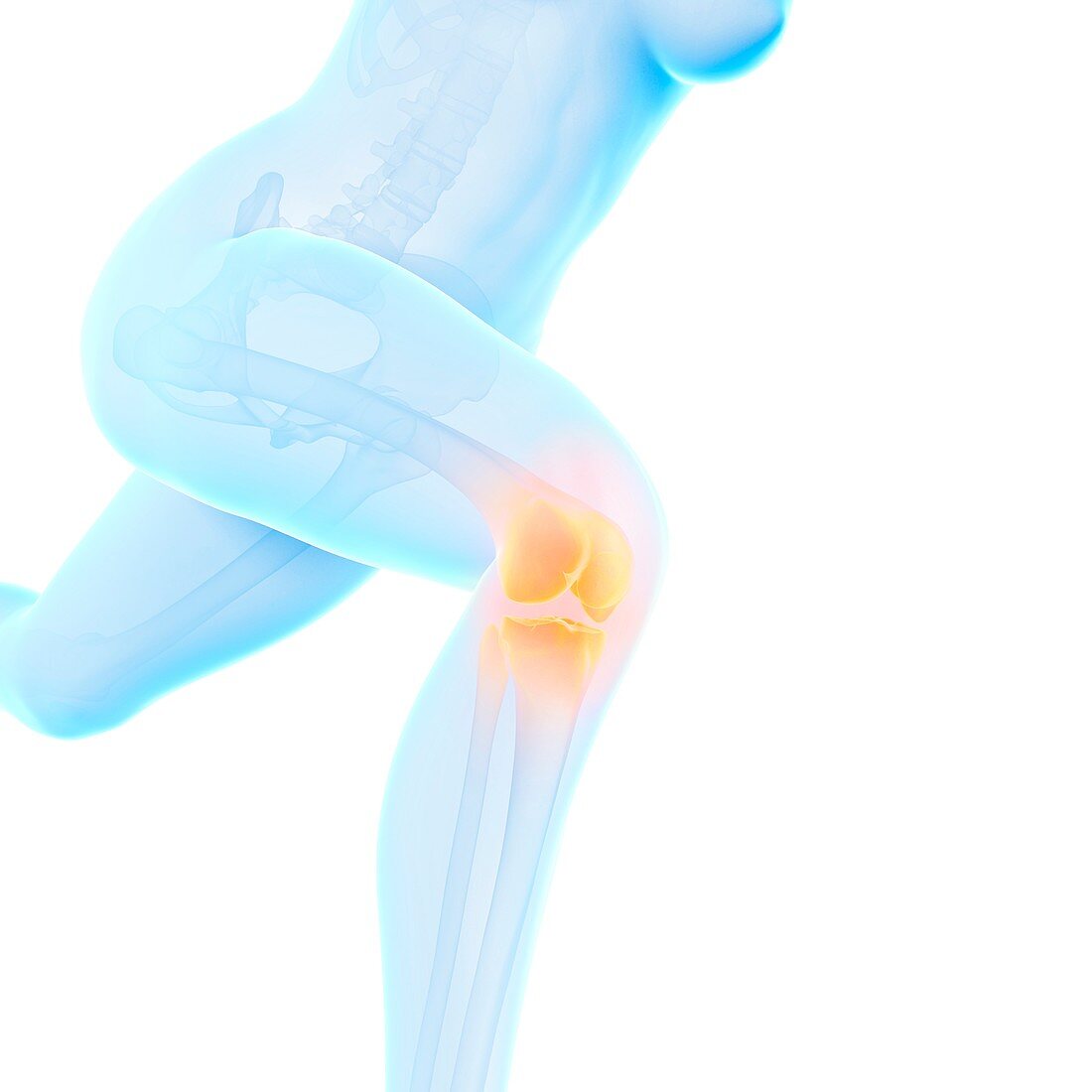 Jogger with knee pain,illustration