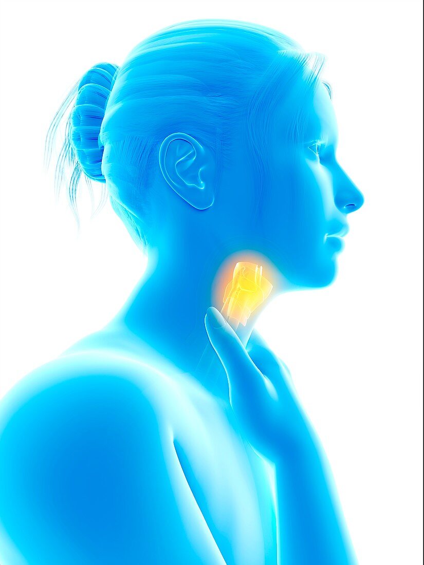Inflammation of the larynx,illustration