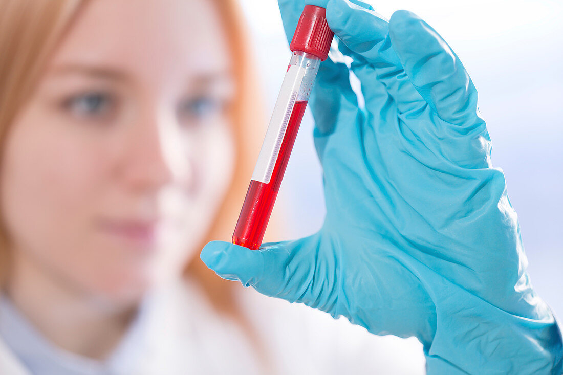 Lab assistant holding blood sample