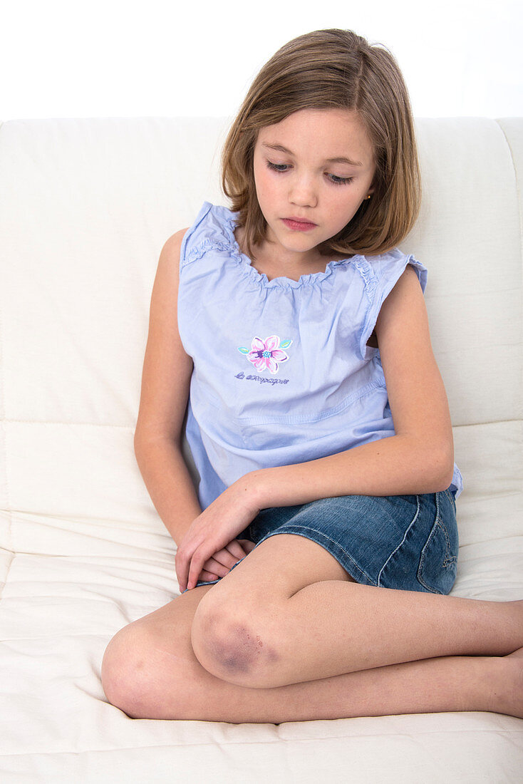 Girl with a bruised knee