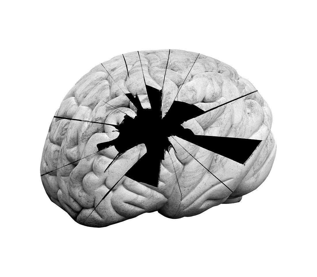 Damaged human brain