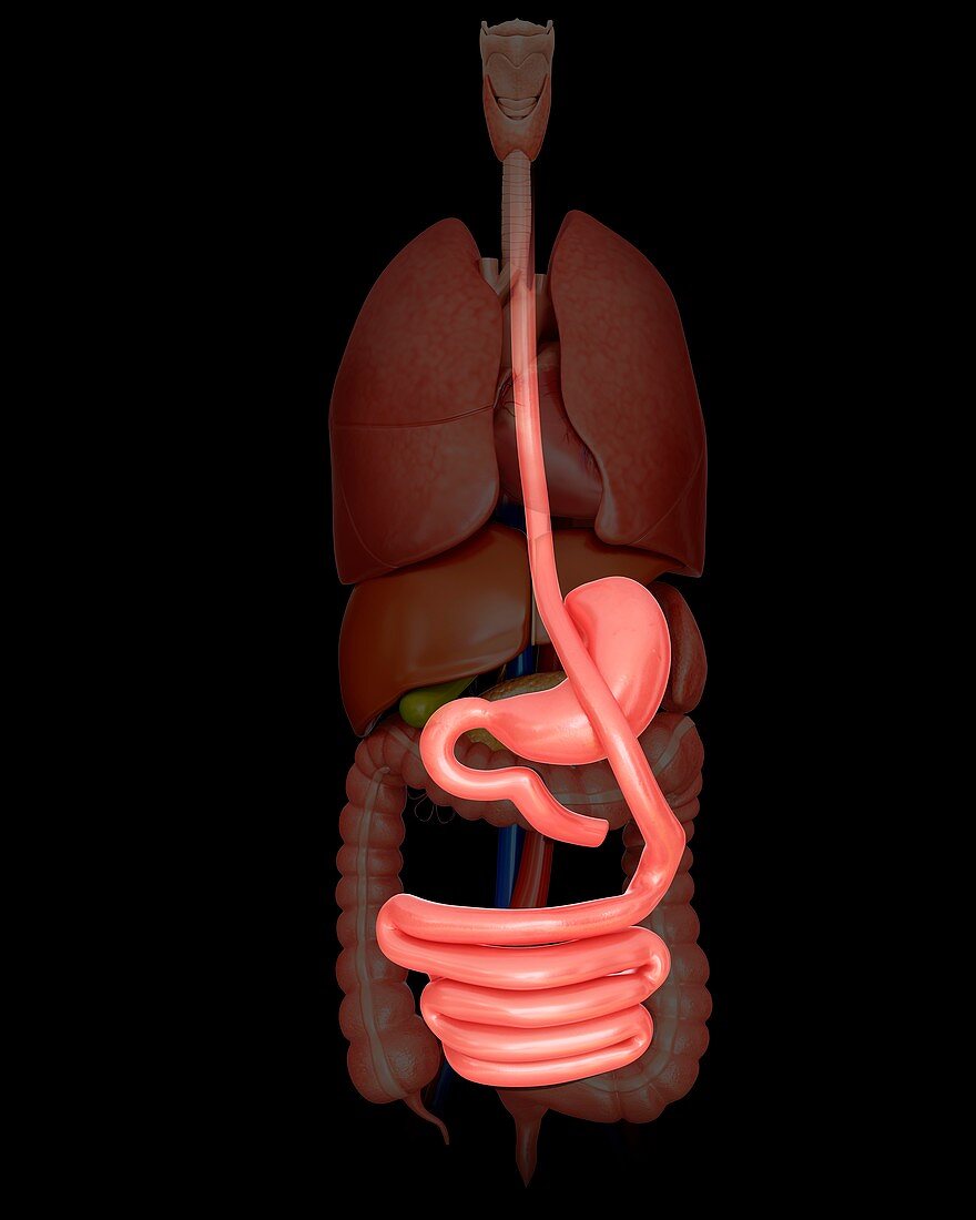 Gastric bypass,illustration