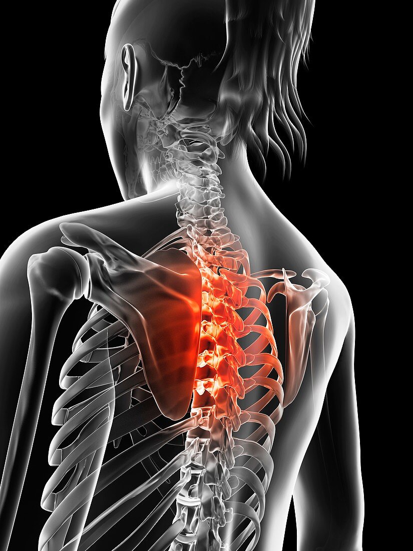 Human thoracic spine pain,Illustration