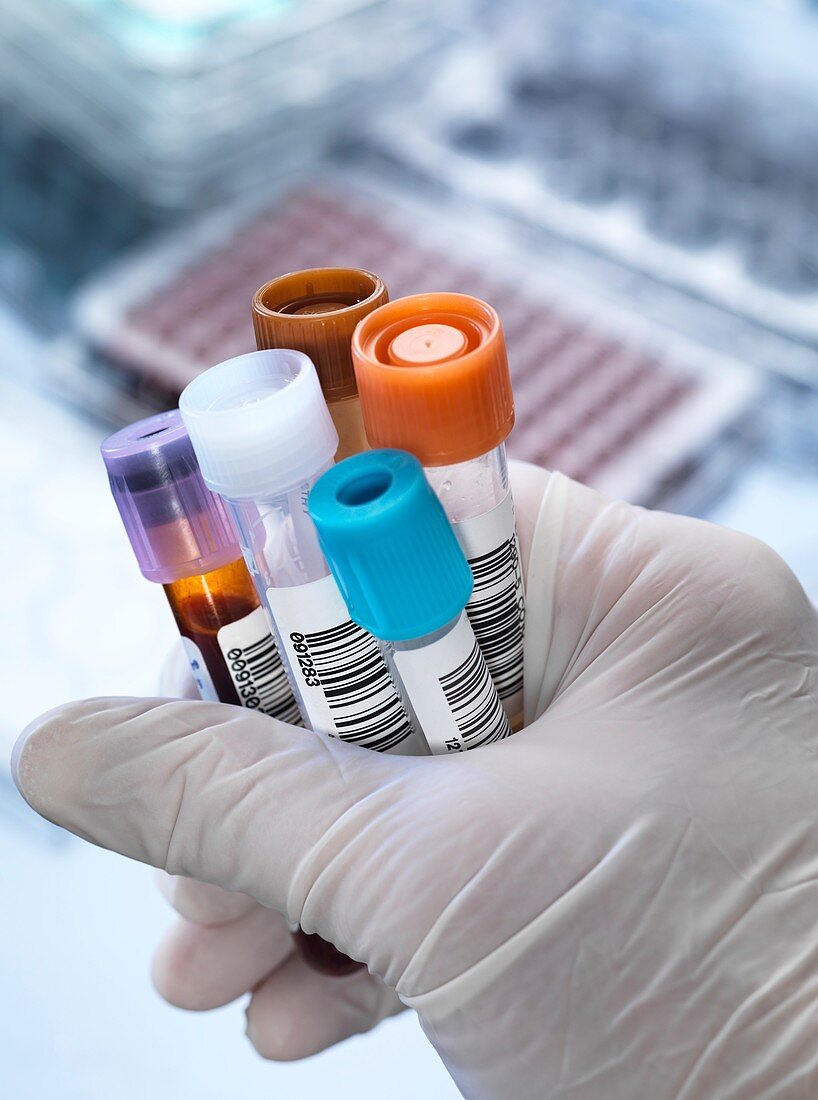 Blood and other samples for testing