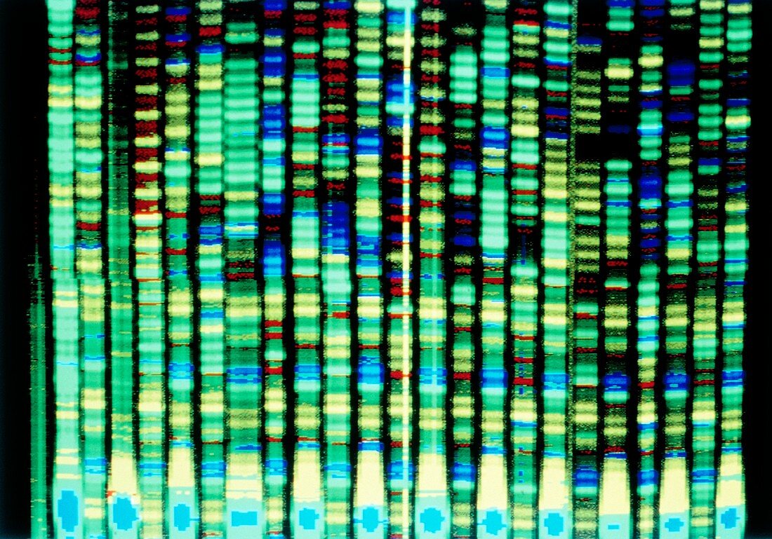 Human genome research: computer DNA sequencing