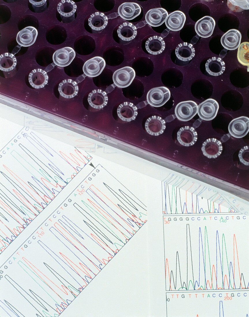 DNA sequence charts used to study colour blindness