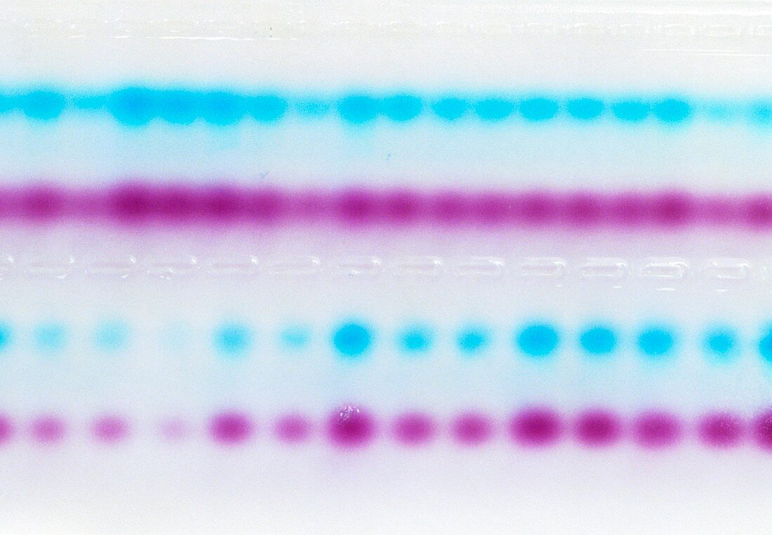 Samples of DNA being separated by an agarose gel