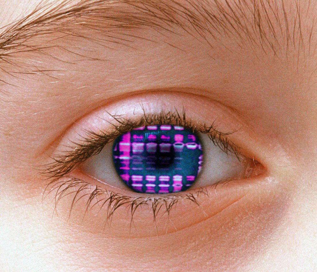Eye and DNA autoradiogram
