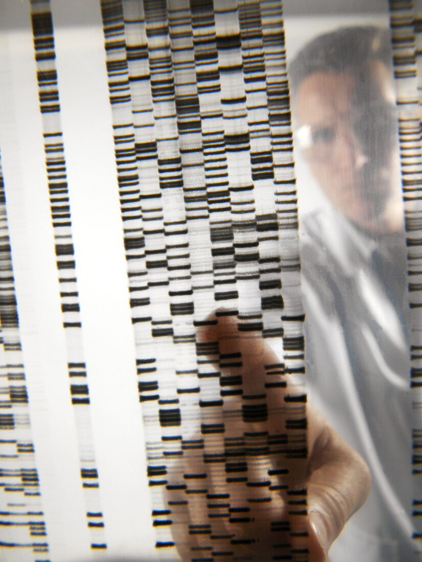 DNA autoradiogram